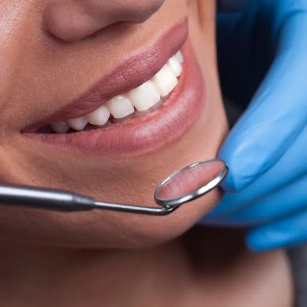 Primo piano di una bocca di donna sorridente