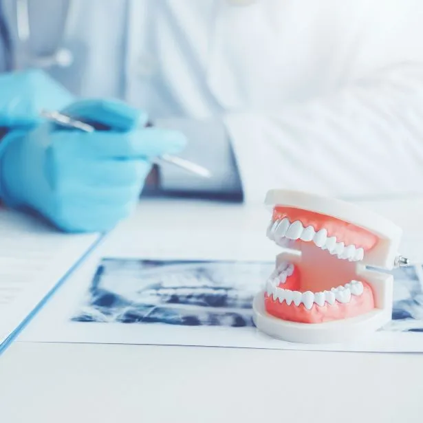 Modellino di dentiera su una scrivania dello Studio Dentistico Firenze - D'Arenzio