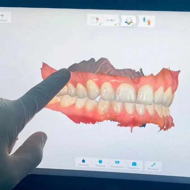 Schermo di un computer che mostra il render 3D di una dentiera presso lo Studio Dentistico Firenze - D'Arenzio
